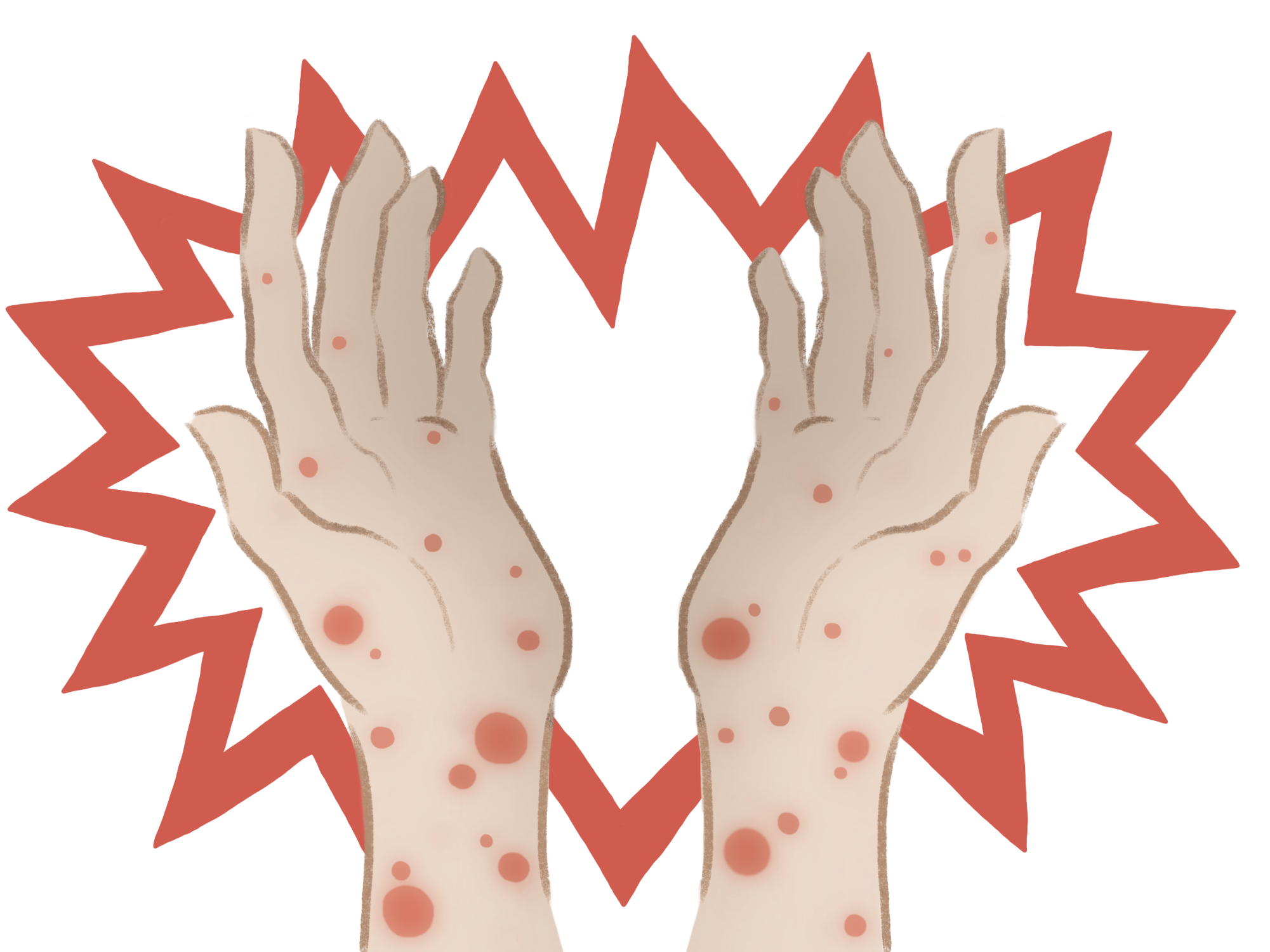 MPox Outbreak Everything You Need Know The Perennial